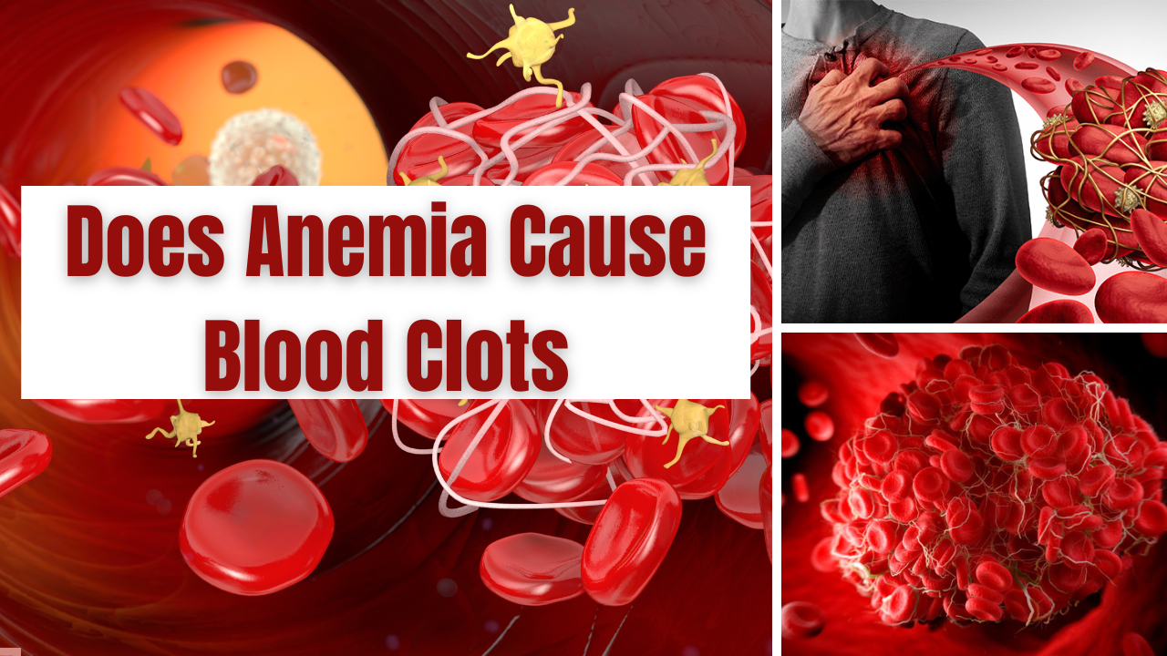 Anemia and Blood Clots The Surprising Link You Need to Know
